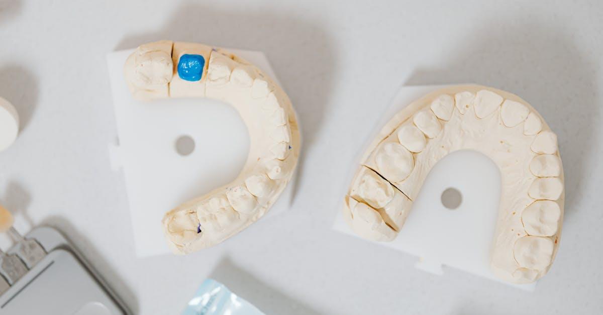 découvrez les implants dentaires, une solution moderne pour remplacer les dents manquantes et retrouver un sourire éclatant. apprenez tout sur leur fonctionnement, les avantages, et comment ils peuvent transformer votre vie.