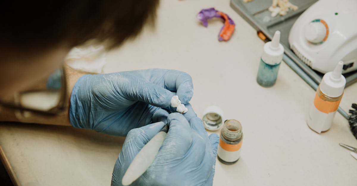 découvrez tout ce qu'il faut savoir sur les implants dentaires : leur fonctionnement, les avantages, les étapes de la procédure et les soins post-opératoires. améliorez votre sourire et votre qualité de vie grâce à cette solution durable et esthétique.