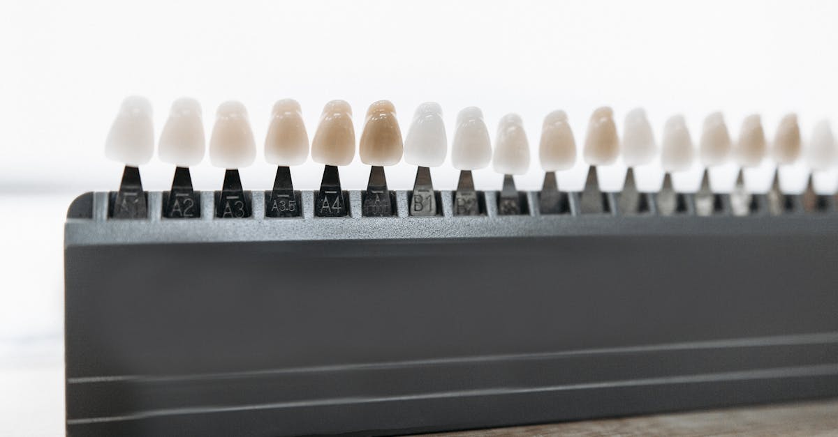 découvrez comment les facettes dentaires peuvent transformer votre sourire avec une solution esthétique durable. idéales pour corriger les imperfections, ces fines coquilles en porcelaine apportent éclat et harmonie à votre dentition. obtenez des conseils d'experts pour choisir la meilleure option pour vous.