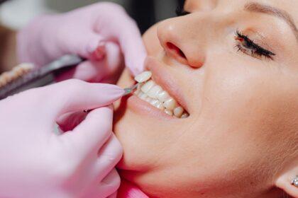 découvrez les facettes dentaires, une solution esthétique pour obtenir un sourire éclatant. fabriquées sur mesure, elles corrigent les imperfections des dents tout en offrant une apparence naturelle et durable. transformez votre sourire dès aujourd'hui !