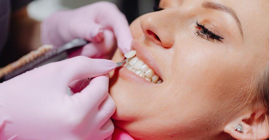 découvrez les facettes dentaires, une solution esthétique pour obtenir un sourire éclatant. fabriquées sur mesure, elles corrigent les imperfections des dents tout en offrant une apparence naturelle et durable. transformez votre sourire dès aujourd'hui !