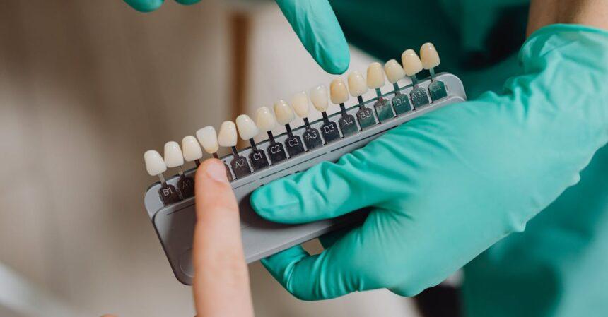 découvrez notre service de blanchiment dentaire pour des dents éclatantes et un sourire radieux. obtenez des résultats visibles rapidement et en toute sécurité grâce à nos techniques modernes. transformez votre sourire dès aujourd'hui!