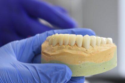 découvrez les implants dentaires all-on-4, une solution innovante pour restaurer un sourire complet en une seule intervention. cette technique permet de fixer rapidement une prothèse dentaire sur seulement quatre implants, offrant confort, esthétique et durabilité. idéal pour ceux qui recherchent une alternative aux prothèses traditionnelles.