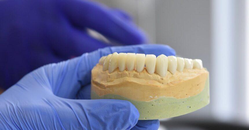 découvrez les implants dentaires all-on-4, une solution innovante pour restaurer un sourire complet en une seule intervention. cette technique permet de fixer rapidement une prothèse dentaire sur seulement quatre implants, offrant confort, esthétique et durabilité. idéal pour ceux qui recherchent une alternative aux prothèses traditionnelles.