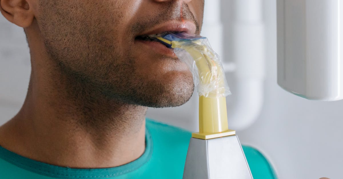 découvrez tout ce qu'il faut savoir sur la sécurité des implants dentaires. obtention d'informations fiables et conseils d'experts pour garantir des procédures sûres et efficaces afin de recouvrer votre sourire en toute tranquillité.